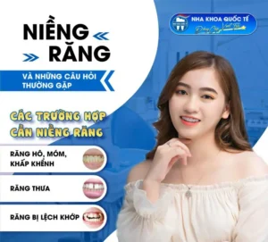 Vấn đề khi niềng răng