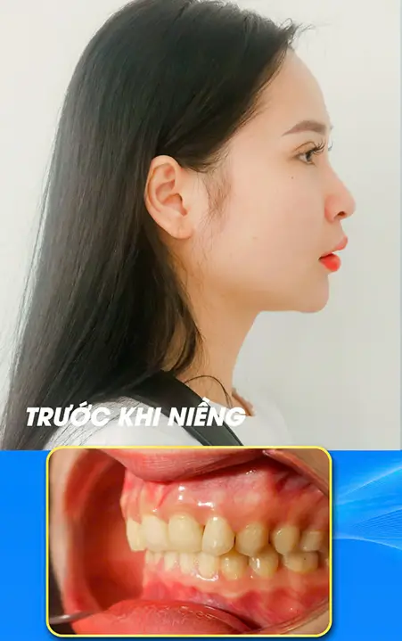 Trước